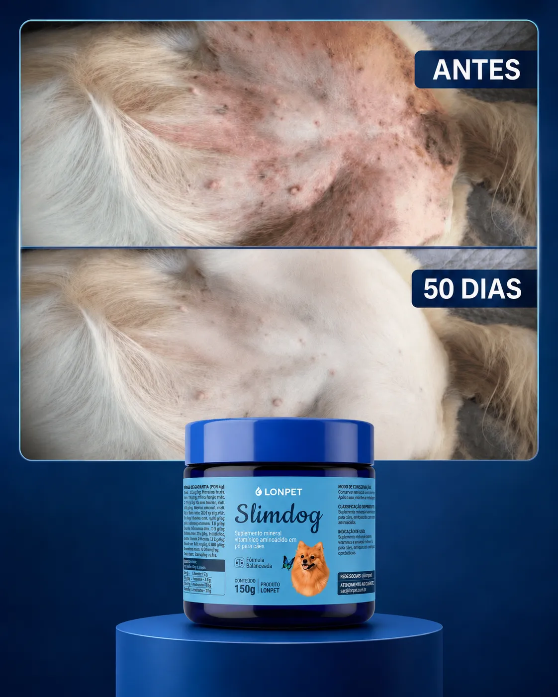 Antes e depois — Pele e barriga